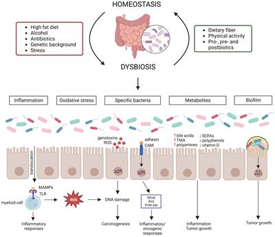 Dissecting the role of the gut microbiome and fecal microbiota transplantation in radio- and immunotherapy treatment of colorectal cancer